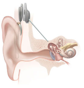 Researchers identify gene associated with age-related hearing loss